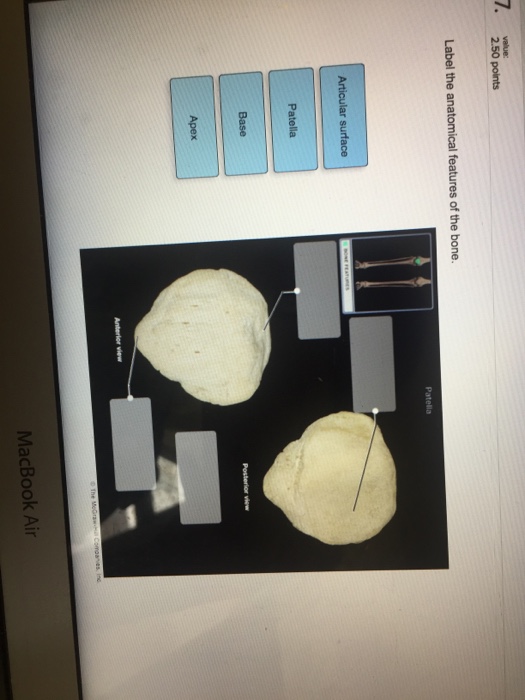 Question: Label the anatomical features of the bone.
