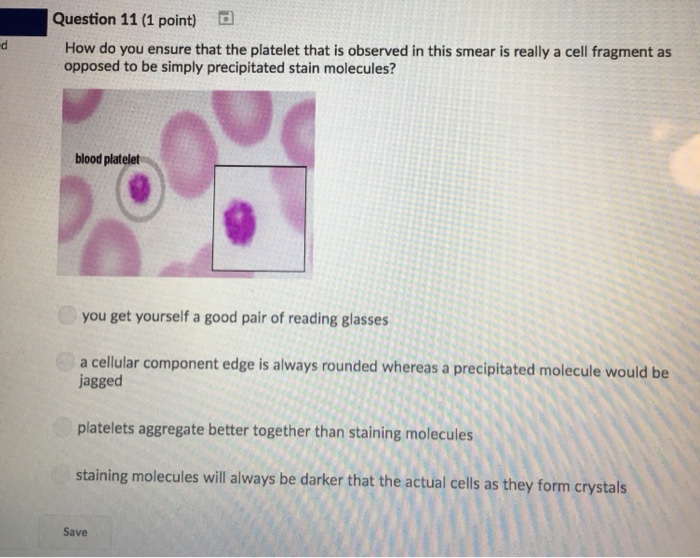 Question: Question 11 (1 point) How do you ensure that the platelet that is observed in this smear is reall...