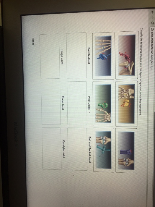 Question: Classify the following into the types if synovial joints they represent.