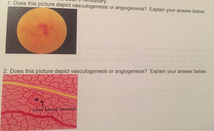 Question: Does this picture depict vasculogenesis or angiogenesis? Explain your answer below.  Does this pi...