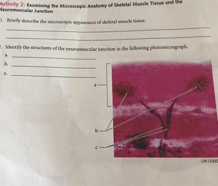 Cardiac muscle vs skeletal muscle image
