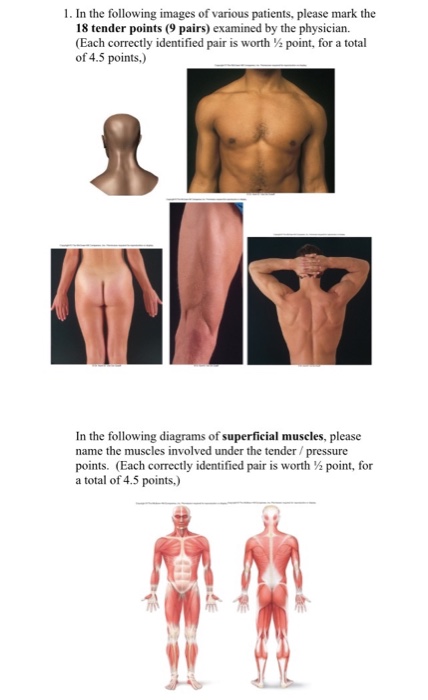 Question: Human Anatomy & Physiology ITheory Case Study #2: 25 Points Case Study 2: Fibromyalgia Case Prese...