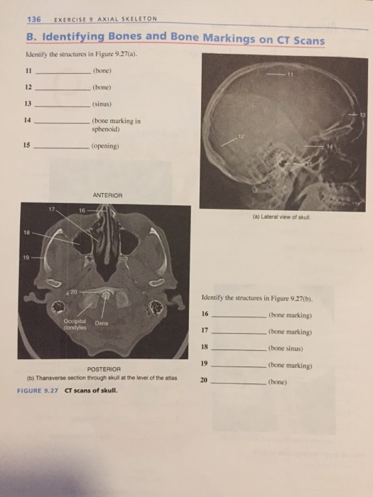 Question: Identify the structures in Figure 9.27(a).  _____ (bone)  _____ (bone)  _____ (sinus)  _____ (bon...