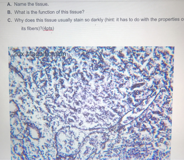 Question: A. Name the tissue. B. What is the function of this tissue? C. Why does this tissue usually stain...