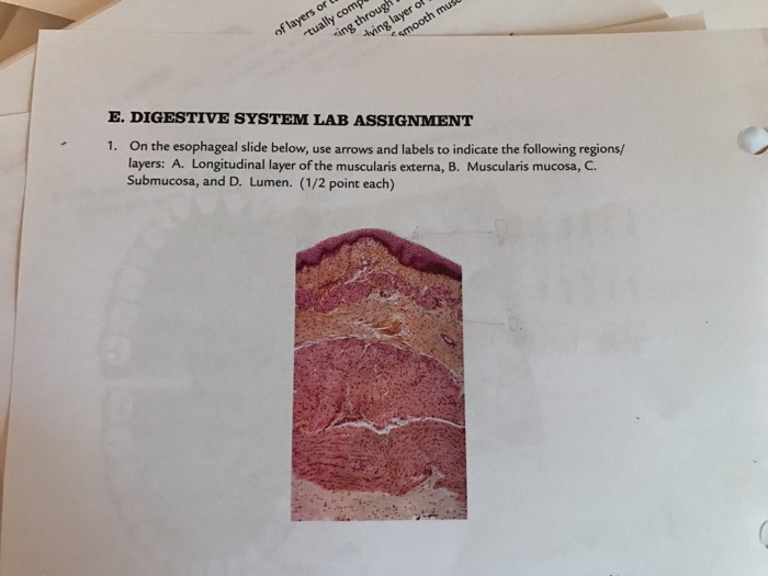Question: On the esophageal slide below, use arrows and labels to indicate the following regions/layers: A....
