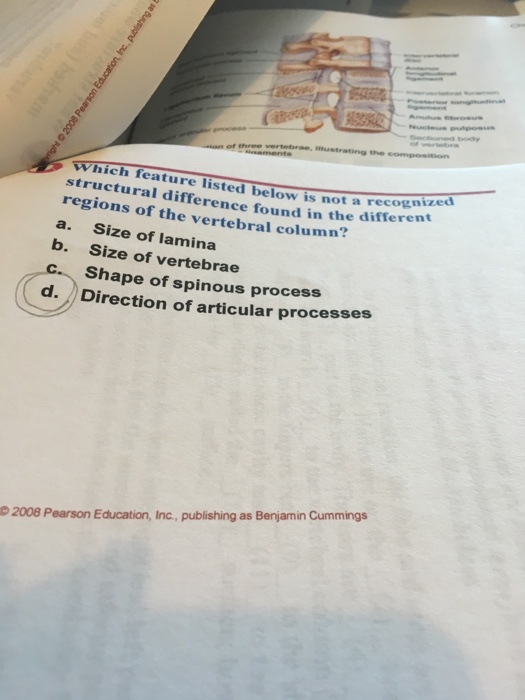 Question: Which feature listed below is not a recognized structural difference found in the different regio...