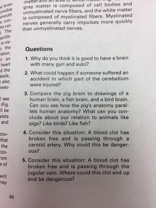 Question: Matter and al ared e m gray matter is composed of cell bodies and e brain otunmyelinated nerve fi...