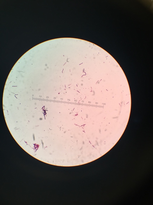 Question: Need to identify an unknown sample that was distributed and kept inan inoculating chamberat 30 ...