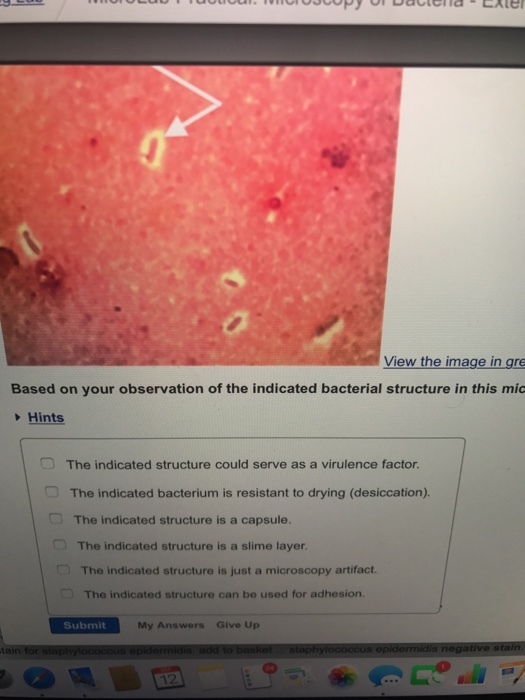 Question: Based on your observation of the indicated bacterial structure in this  The indicated structure c...