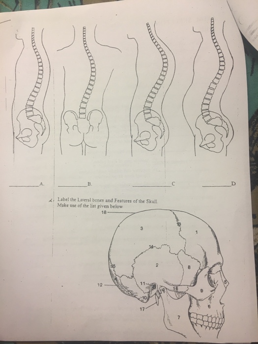 Question: Label the Lateral bones and Features of the Skull. Make use of the list given below.