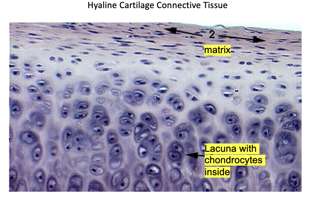 Solved Hyaline Cartilage Connective Tissue Matrix Lacuna Chegg