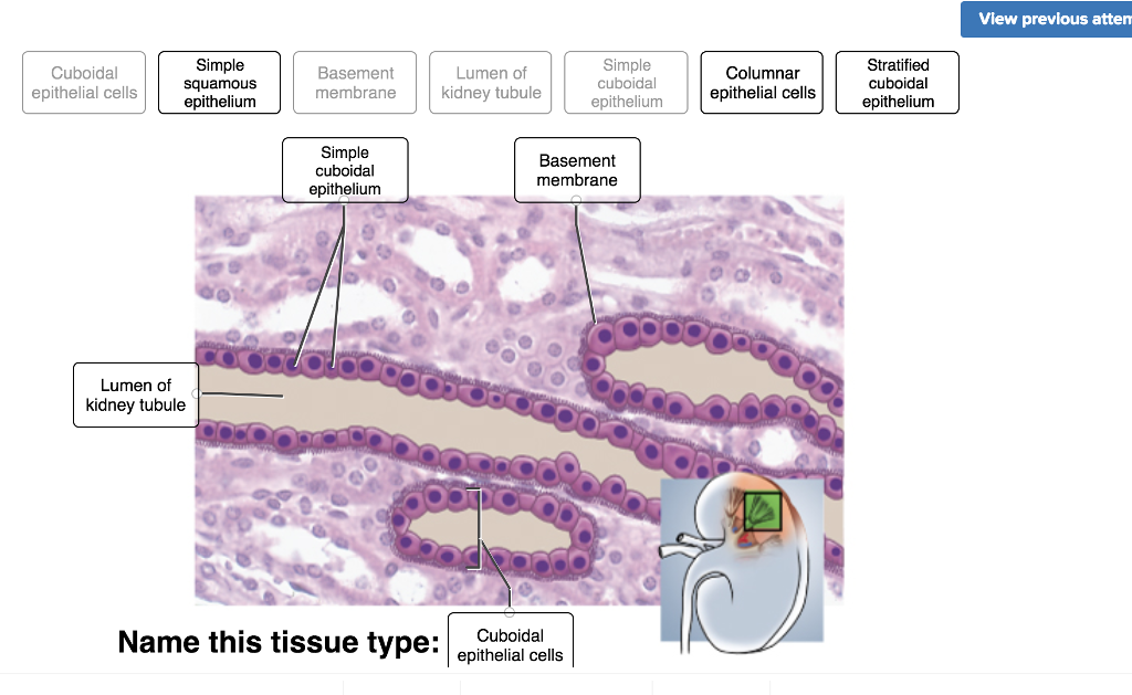 Simple Cuboidal Epithelium Labeled Basement Membrane