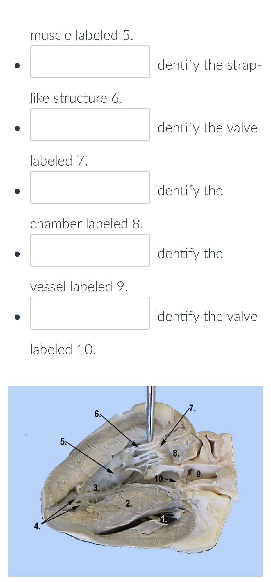 Solved Muscle Labeled Identify The Strap Like Chegg