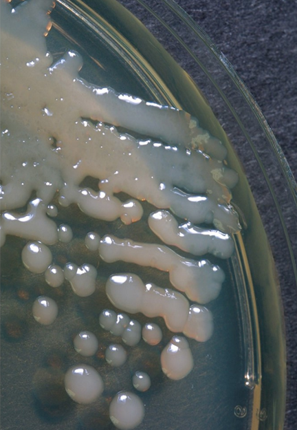 Solved Describe The Colony Morphology Elevation And Whole Chegg