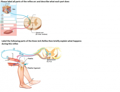 Solved Please Label All Parts Of The Reflex Arc And Describe Chegg