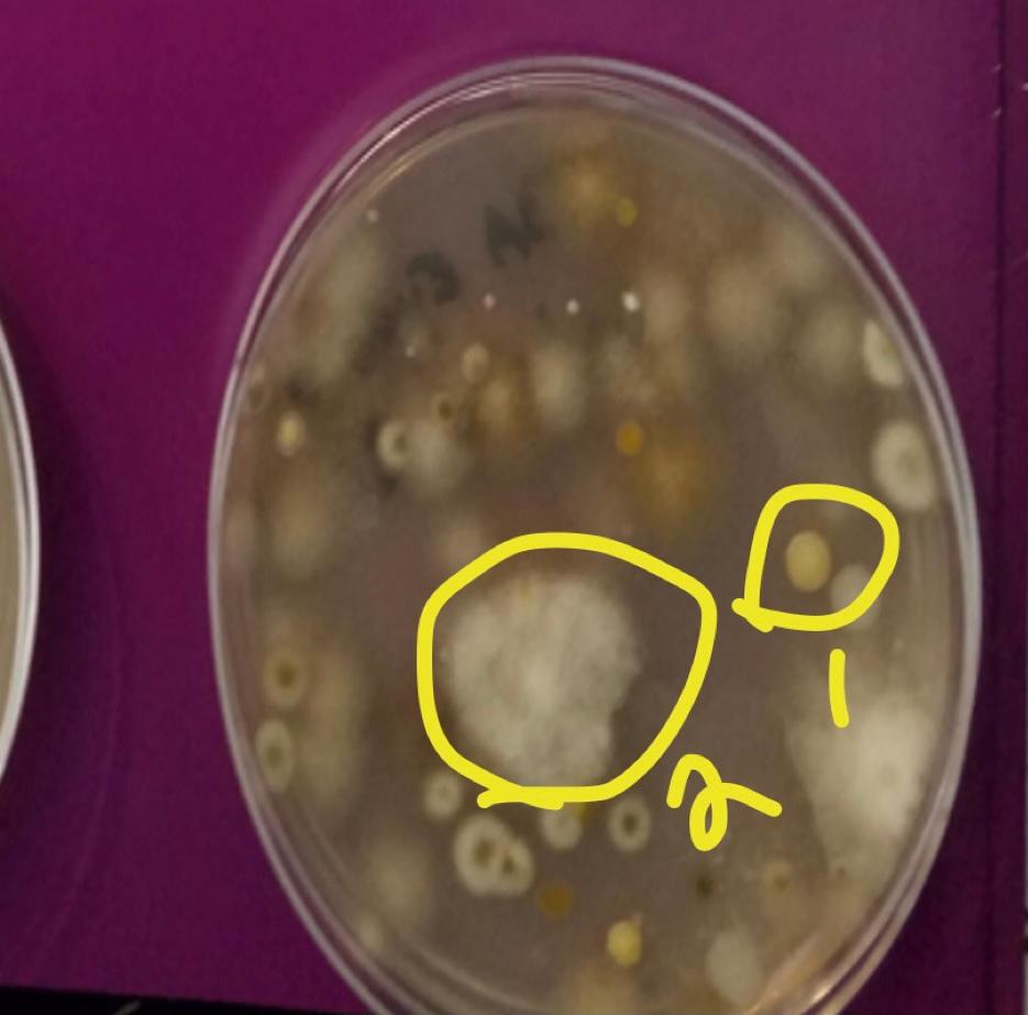 Solved Please Describe The Colony Morphology Of These 2 Chegg