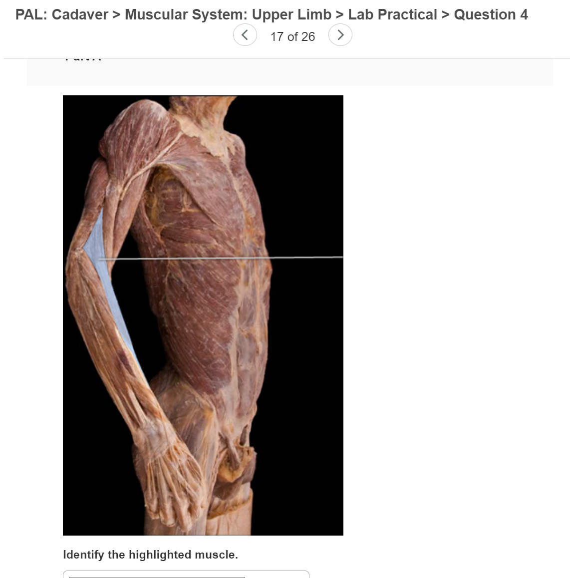 Solved Pal Cadaver Muscular System Head And Neck Lab Chegg