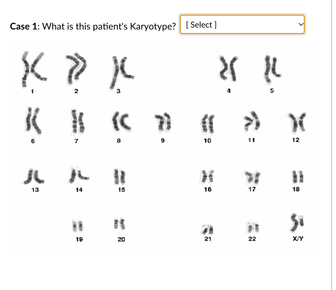 Solved Case 1 What Is This Patient S Karyotype Select Chegg