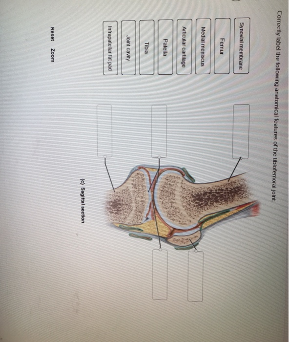 Solved Correctly Label The Following Anatomical Features Of Chegg