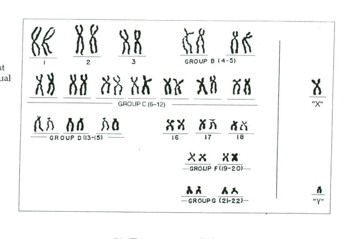 Solved The Karyotype Above Came From And Individual Who Is Chegg