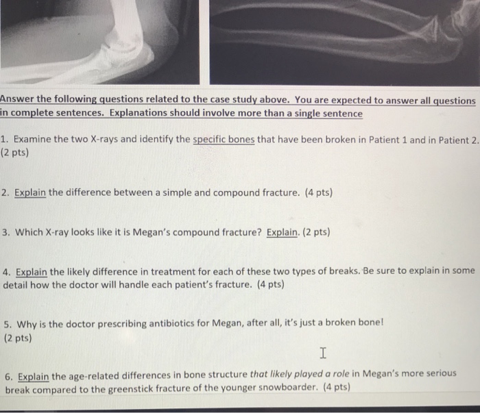 Solved Spring Break Case Study Ol Saved To This Pc Layout Chegg