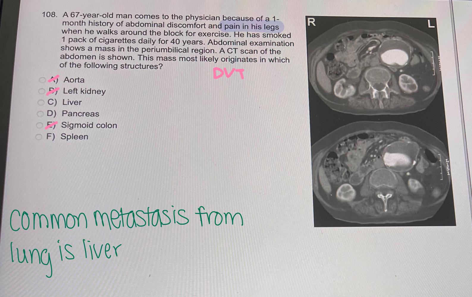 Solved A Year Old Woman Comes To The Physician Chegg