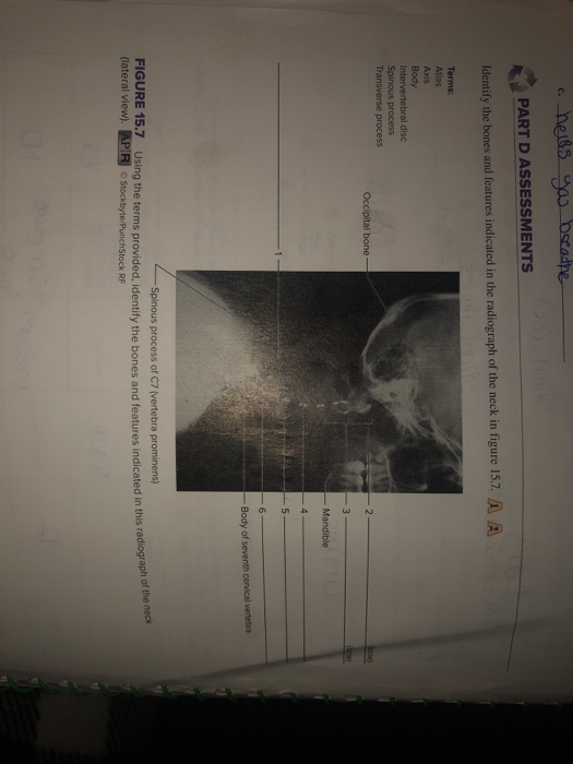 Solved Part D Assessments Identify The Bones And Features Chegg