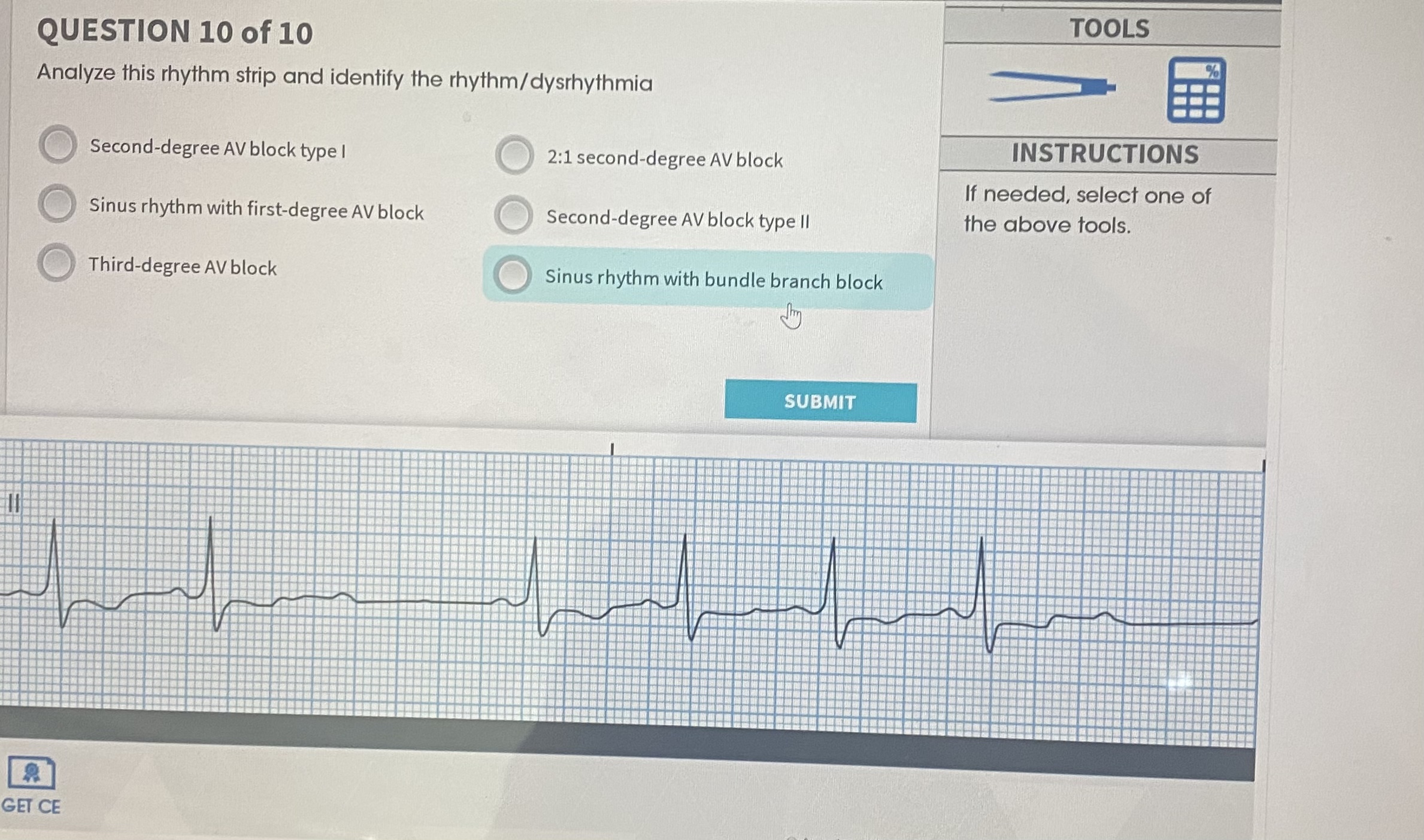 Analyze This Rhythm Strip And Identify The Chegg