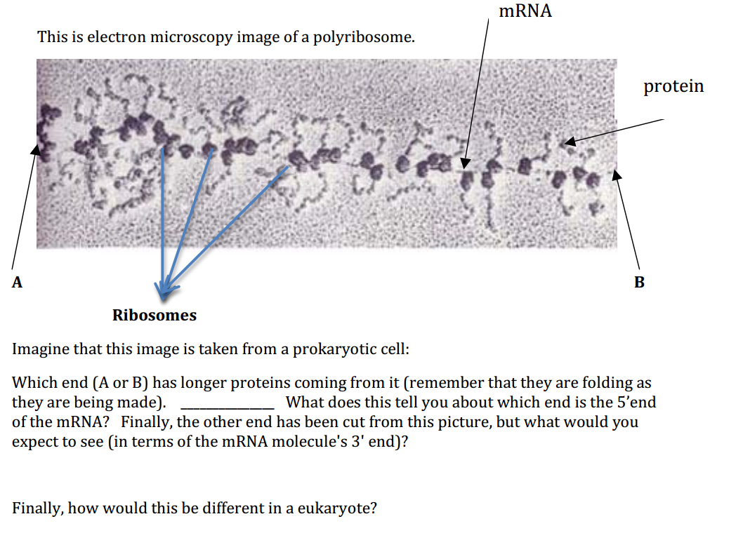 This Is Electron Microscopy Image Of A Polyribosome.