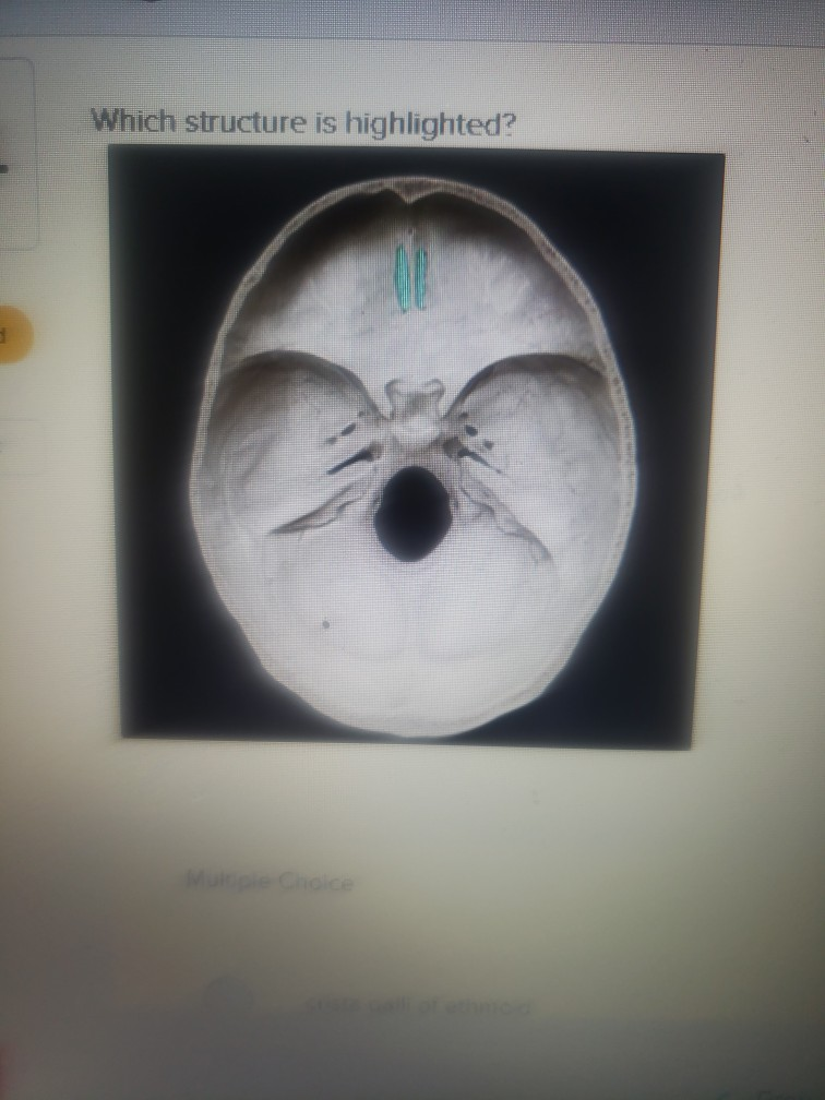 Solved Which Structure Is Highlighted System 2 A Save Chegg