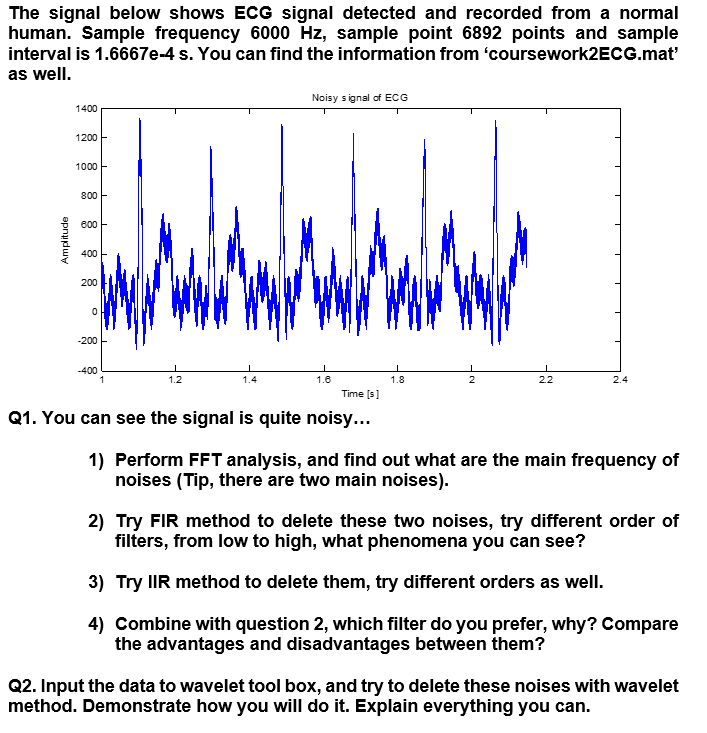 Solved The Signal Below Shows Ecg Signal Detected And Chegg