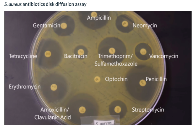 Solved E Coli Antibiotics Disk Diffusion Assay Ampicillin Chegg