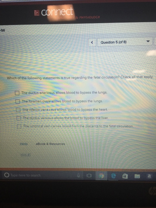 Solved Which Of The Following Statements Is True Regardin...