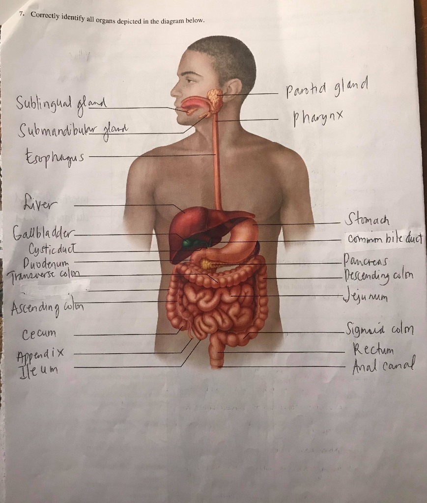 Solved Correctly Identify All Organs Depicted In The Chegg