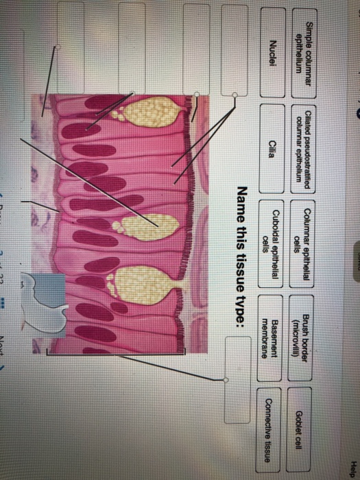 Correctly Identify This Tissue Type Practice