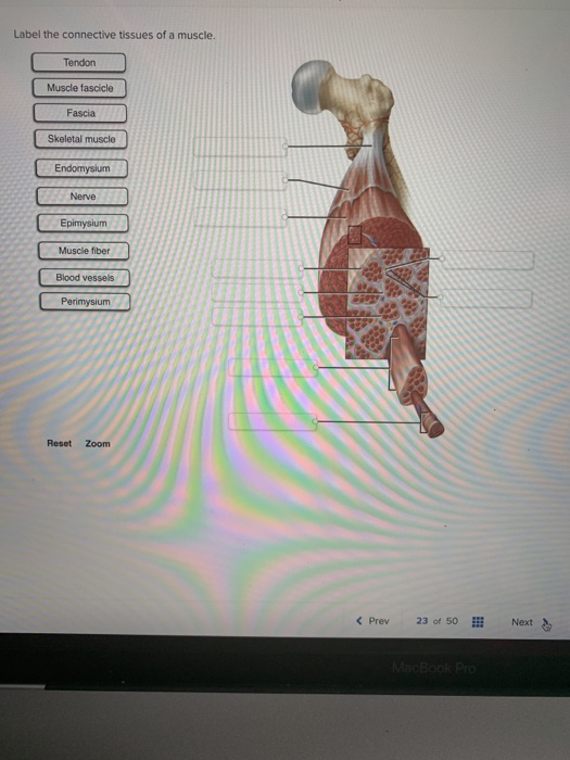 Solved Label The Skeletal Muscles And Connective Tissues My XXX Hot Girl