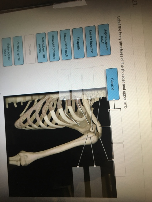 Solved Label The Bony Structures Of The Shoulder And Upper Chegg