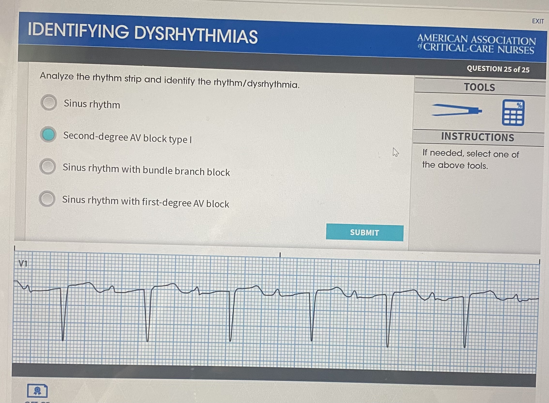 Solved Analyze The Rhythm Strip And Identify The Chegg