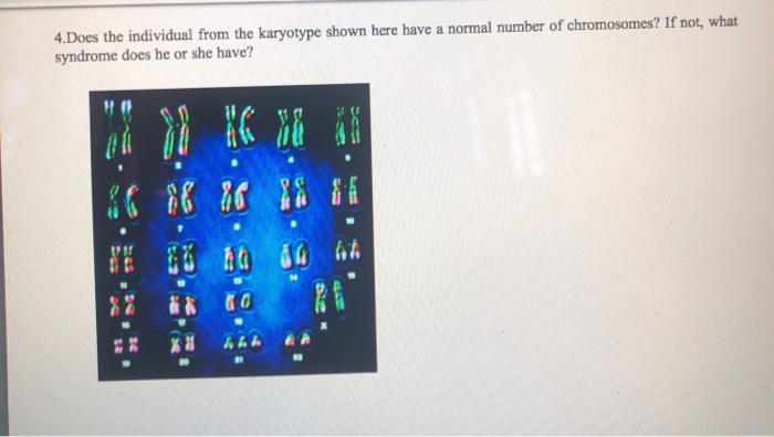 Solved Does The Individual From The Karyotype Shown Here Chegg