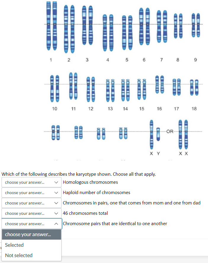 Solved Which Of The Following Describes The Karyotype Shown Chegg