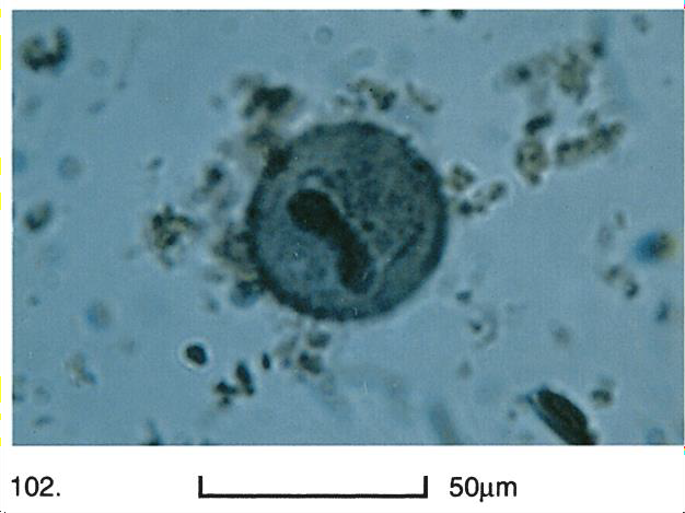 Solved Chapter 6 Protozoa Intestinal Flagellates And Chegg