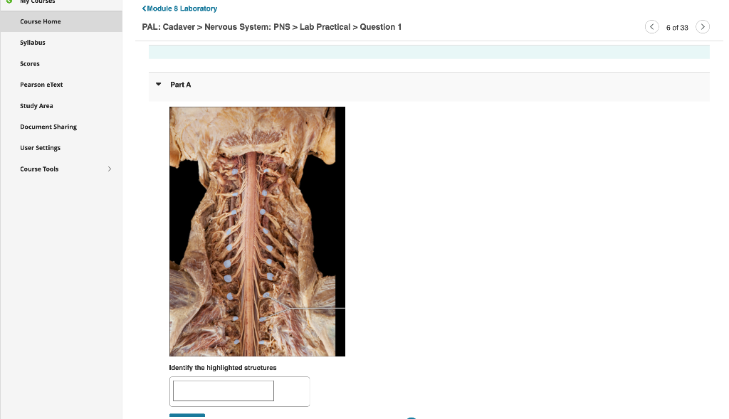 Solved Pal Cadaver Nervous System Pns Lab Practical Chegg