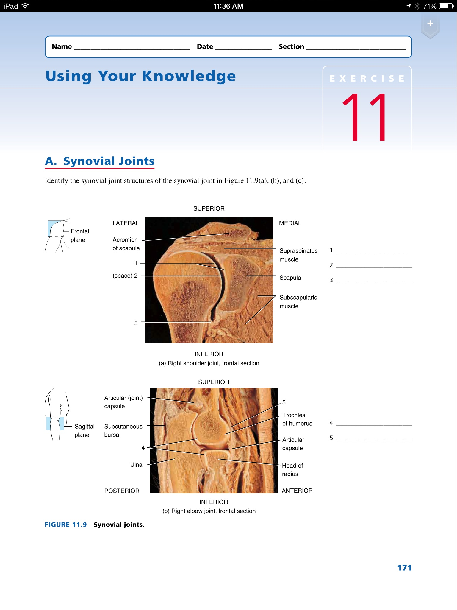 Interactive Anatomy: Test Your Synovial Joint Knowledge! - 2hfu09u