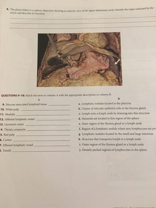 Solved 8 The Photo Below Is A Cadaver Dissection Showing An Chegg