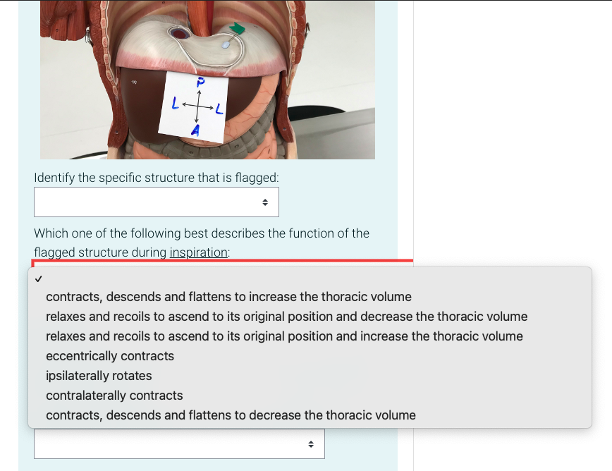 Solved Identify The Specific Structure That Is Flagged Chegg