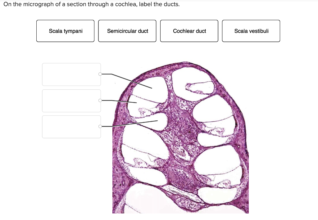 Solved On The Micrograph Of A Section Through A Cochlea Chegg