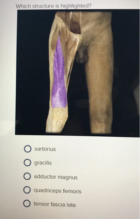 Solved Which Structure Is Highlighted O Rectus Abdominis Chegg