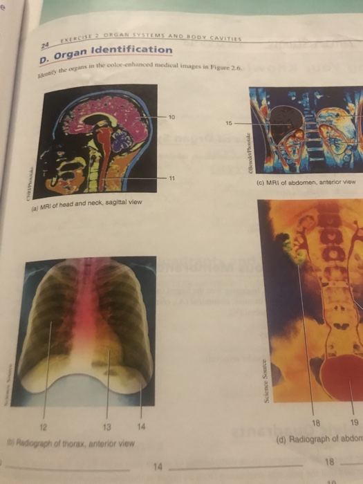 Solved Organ Systems And Body Cavitles X Rcse Organ Chegg