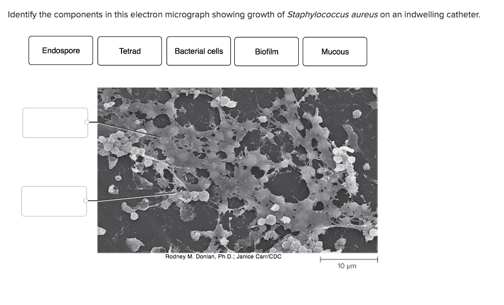 Solved Identify The Components In This Electron Micrograph Chegg