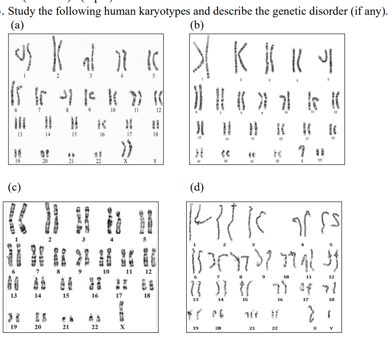 Solved Study The Following Human Karyotypes And Describe The Chegg